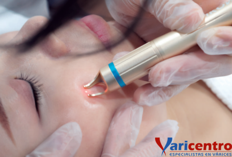 LASER DIODO 980nm PARA ARAÑAS VASCULARES