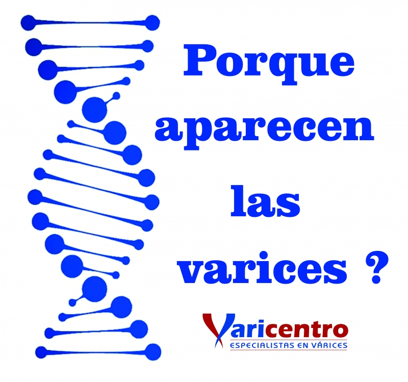 ¿POR QUÉ APARECEN LAS VARICES?
